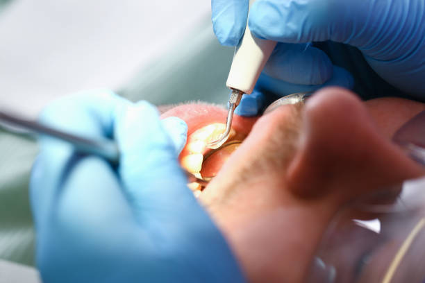 Best Emergency Tooth Extraction in Mangum, OK