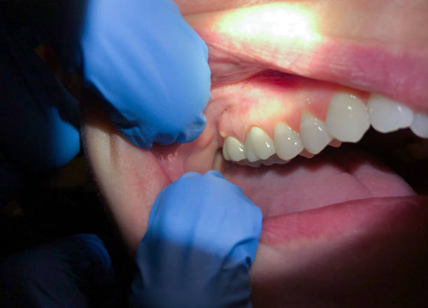 Best Walk-In Emergency Dentist in Mangum, OK