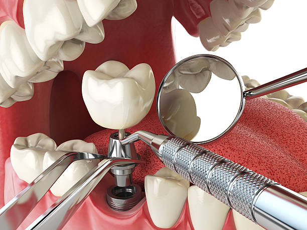 Best Walk-In Emergency Dentist in Mangum, OK